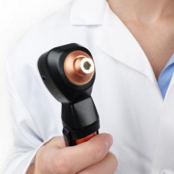 Otoscope Smartled Spengler X Luxamed Edition® Bronze | ADAM Orthopédie & Matériel Médical