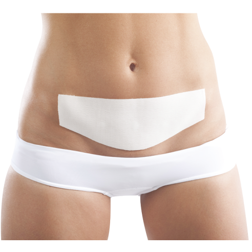 Césarpatch Gel Z® 3 mm MP005  Médical Z |  ADAM Orthopédie