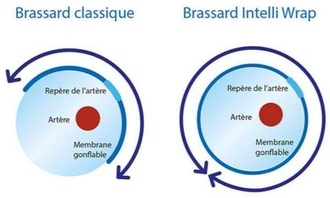 schéma du principe de fonctionnement du brassard avec technologie intelli wrap